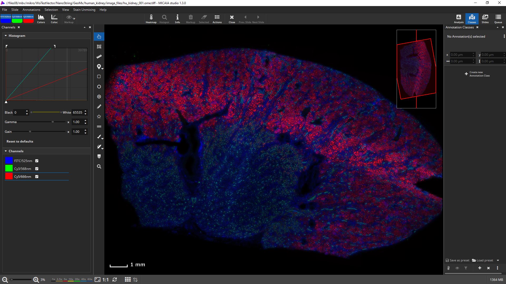 "Human Kidney" scanned with NanoString GeoMx DSP (slide copyright @ NanoString) 