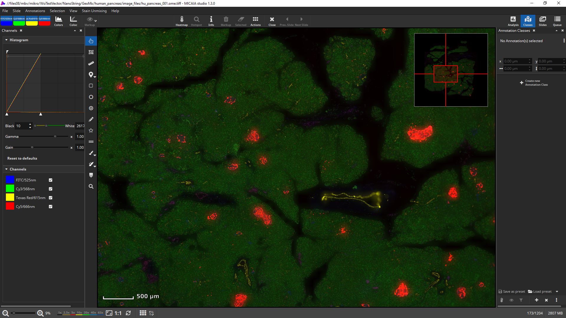 "Human Pancreas" scanned with NanoString GeoMx DSP (slide copyright @ NanoString) 