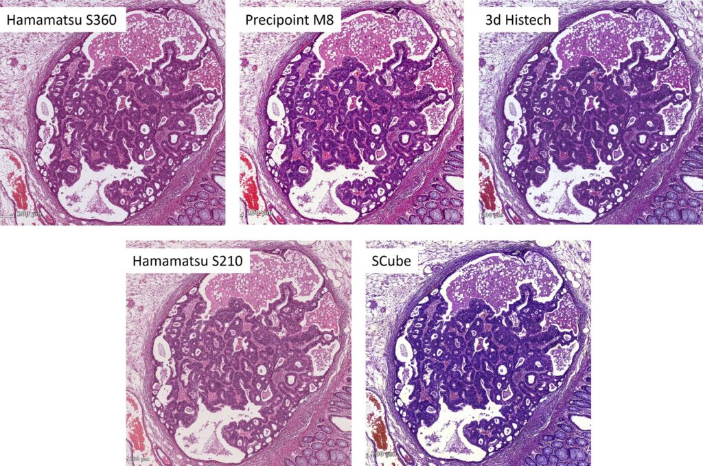 Intestinal tissue sections (with adenocarcinoma), digitized with scanners from different vendors