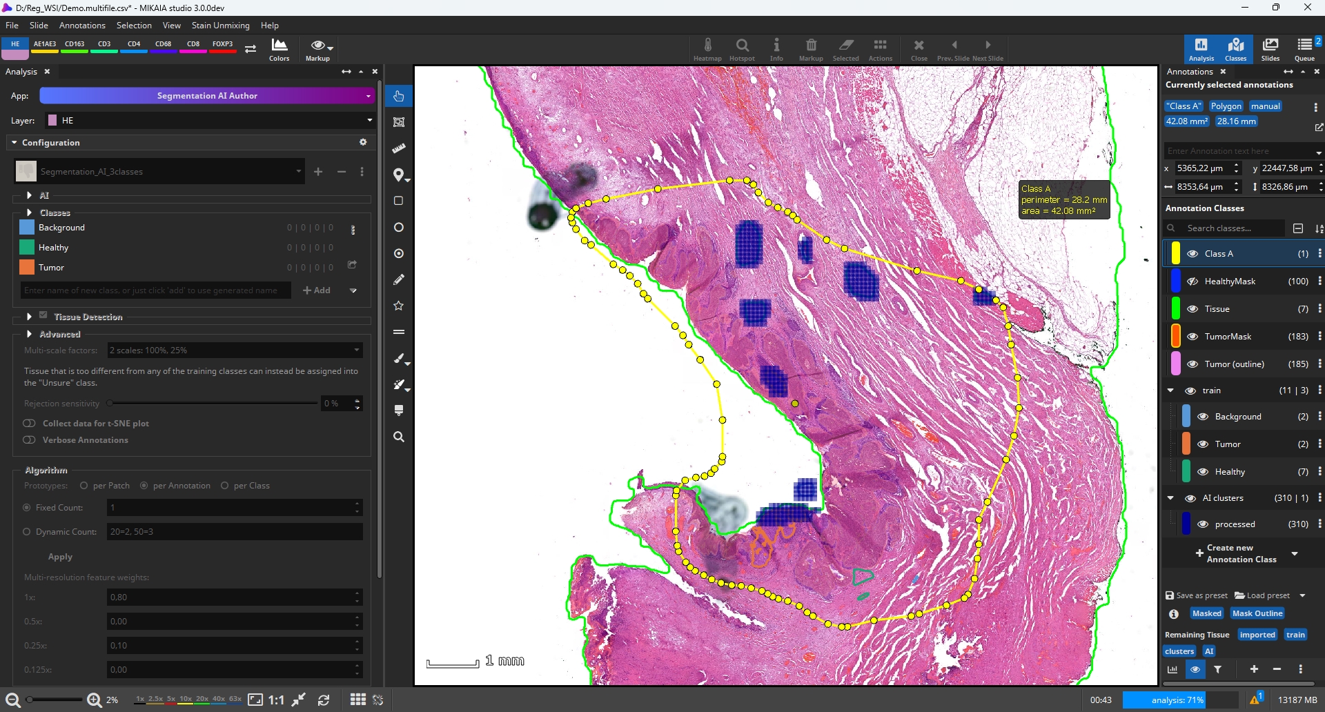 screenshot of masks derived from the PCK IHC layer